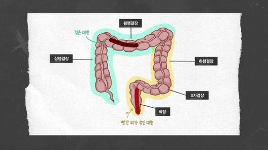 중앙일보