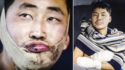 우크라이나가 공개한 생포된 북한 군인 2명. 사진=젤렌스키 SNS 캡처