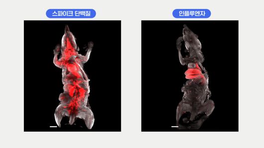 스파이크 단백질은 뇌에 들어와 미세 출혈을 일으키기도 했다. 직접적으로 뇌를 손상시켜 뇌졸중 위험을 높이고 후유증을 일으킬 위험이 확인됐다.