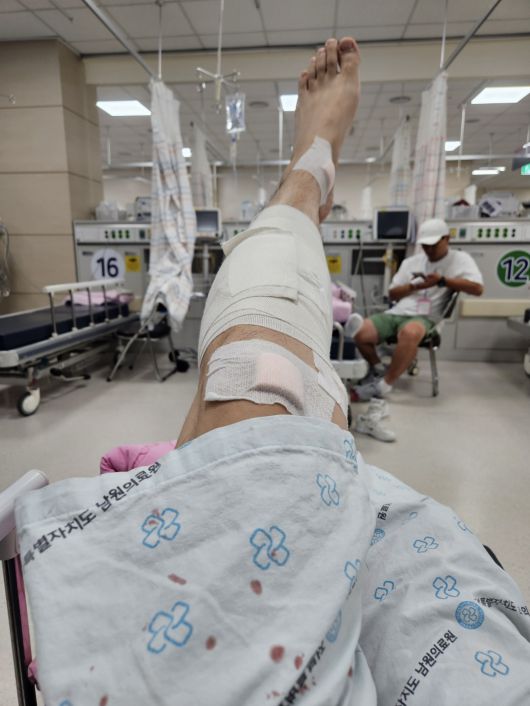 지난 21일 '남원 싱크홀 사고'로 팔다리 등을 다친 박모(46)씨가 사고 당일 남원의료원에서 응급 치료를 받은 모습. 사진 박씨