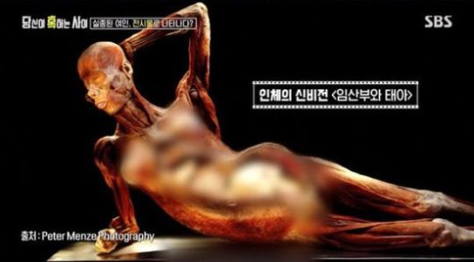 장웨이제라는 추측이 나온 ‘인체의 신비’ 전시회 표본. 사진lSBS