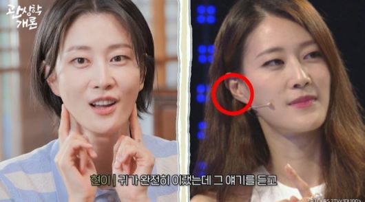 이현이가 귀 필러 시술 사실을 털어놨다. 사진ㅣ유튜브 채널 ‘티티 스튜디오’ 방송 캡처