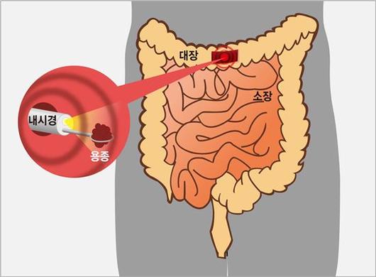 아시아경제