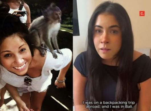 인도네시아 발리에서 메탄올 중독으로 시력을 잃은 캐나다 여성 애슐리 킹의 사고 전(왼쪽) 모습과 소셜미디어(SNS)를 통해 여행객들에게 경각심을 당부하는 모습. 인스타그램 캡처