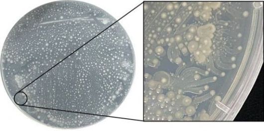 스틱스 빙하 코어에서 발견돼 잠재적 병원성 균주로 확인된 균주의 고체 배양 모습. 극지연구소