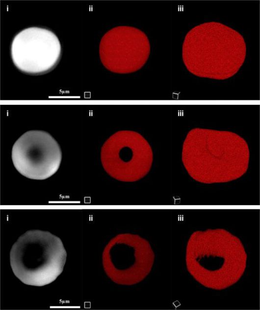 삼투 조건에 따른 혈구 형상 변화를 홀로토모그래피 현미경으로 관찰.