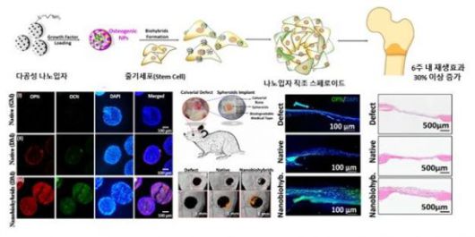나노입자-직조 줄기세포 기반 스페로이드의 뼈 재생 효과 입증을 설명하는 그림. 연구팀 제공