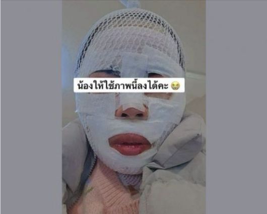 화상 입은 태국인 아내. SNS 갈무리