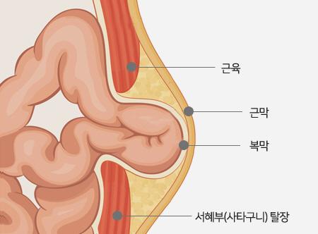 이데일리