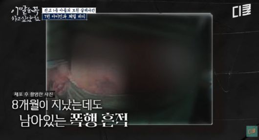 사진=tvN 이 말은 꼭 하고 싶었어요