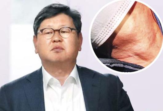 '택시기사 폭행' 이용구 법무차관 6개월 만에 첫 소환조사 ...