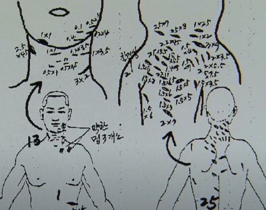 피해자인 박한상 부모의 부검 소견서 중 일부. /MBC 유튜브 영상