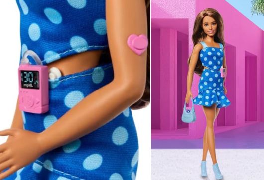 제1형 당뇨병 바비 인형./마텔