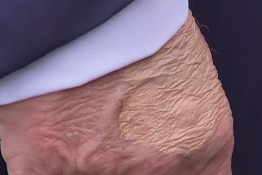 지난달 15일 도널드 트럼프 미국 대통령의 오른쪽 손등에 화장품을 덧바른 모습이 포착됐다. /데일리메일