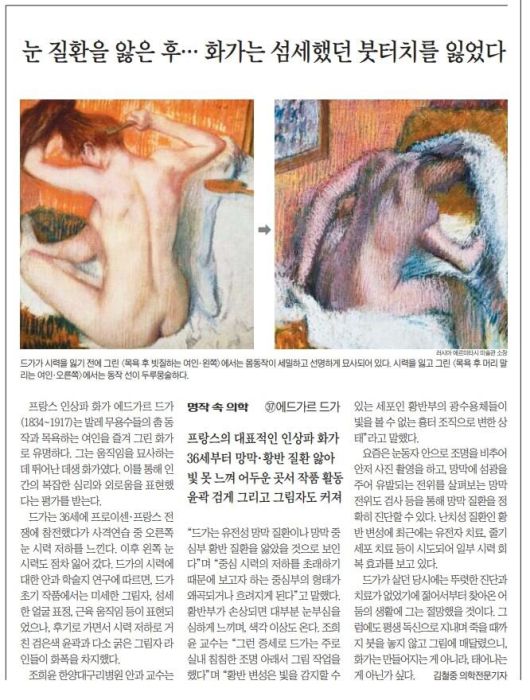 시력을 잃은 에드가르 드가, 섬세한 붓터치를 잃었다. 2022년 11월 24일자.