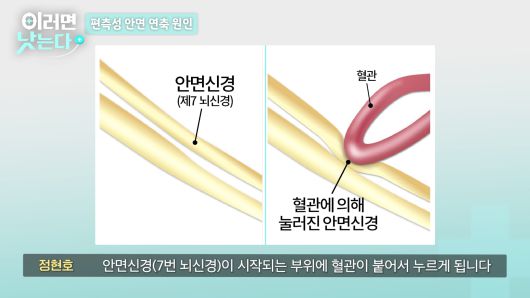 /조선일보 의학·건강 유튜브 '이러면 낫는다'