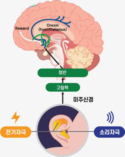 비침습 미주신경 자극 기술의 원리 / 출처=뉴라이브