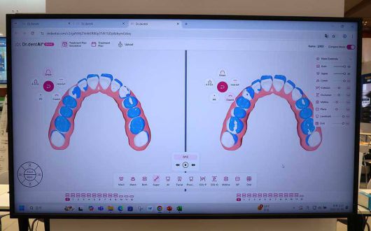 닥터덴트AI는 서로 다른 치료 옵션 시나리오를 동시에 보면서 비교할 수 있다 / 출처=IT동아