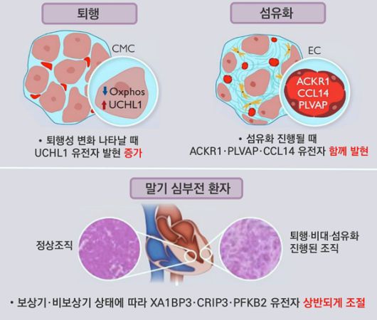 희귀·난치성 심근병증, 발병 단계·조직 손상 따라 달라지는 유전자 규명