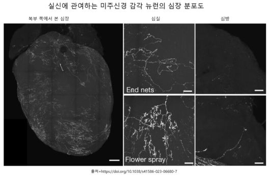 실신에 관여하는 감각뉴런은 심방보다 심실에 주로 분포해 있다.
