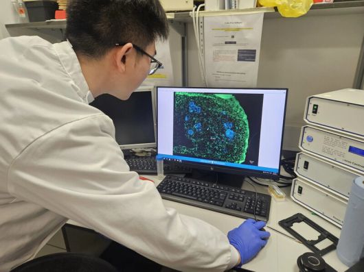 연구진이 컴퓨터로 치아 세포를 살펴보고 있다. 킹스칼리지런던 제공