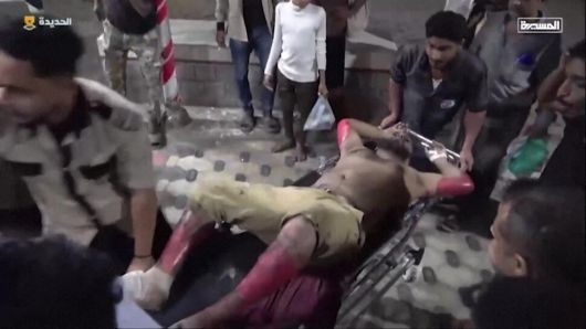 18일(현지시각) 예멘 서부 라스 이사 연료 항구를 미군이 공습해 부상당한 이들이 구급차를 타고 병원에 도착하고 있다. 알마시라 텔레비전 영상 갈무리. AFP 연합뉴스