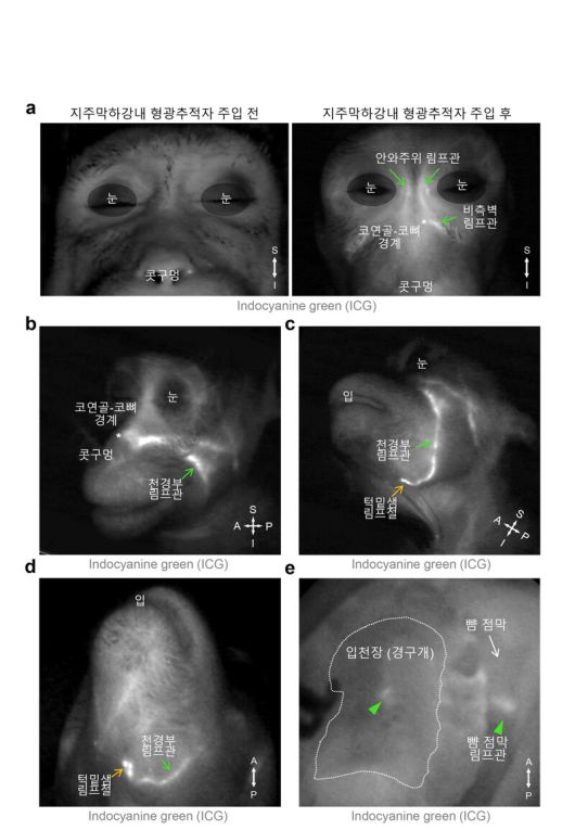 영장류에서 관찰된 뇌척수액 배출 림프관 분포. 지주막하강은 뇌와 척수를 둘러싸고 보호하는 세 개의 뇌막 중 두번째와 세번째 막 사이에 있는 공간을 말한다. 기초과학연구원 제공