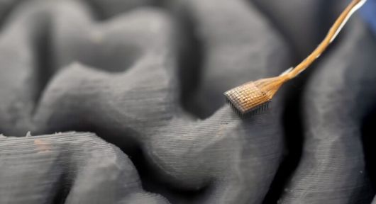 미세전극 칩을 이식한 뇌의 모형. UC데이비스 제공