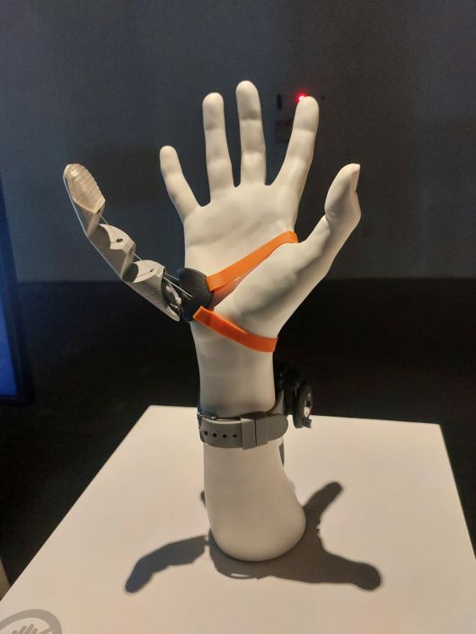 ‘2025 광주디자인비엔날레’에 출품된, 영국 케임브리지대학 디자인팀이 연구 개발한 로봇 엄지손가락 연장 장치 ‘세번째 엄지손가락’. 노형석 기자