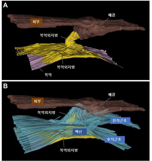 배꼽집의 3차원 구조도. 도쿄과학대 제공