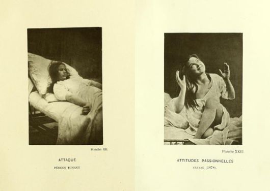 프랑스 신경학자 장 마르탱 샤르코가 치료했던 히스테리아 여성 환자들의 모습이 실린 책 '살페트리에르 병원의 초상 사진' 일부. 웰컴콜렉션 제공