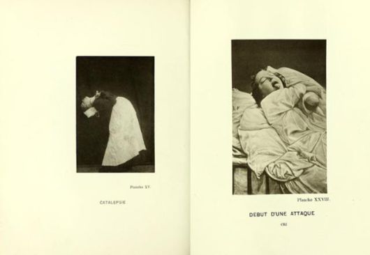 프랑스 신경학자 장 마르탱 샤르코가 치료했던 히스테리아 여성 환자들의 모습이 실린 책 '살페트리에르 병원의 초상 사진' 일부. 웰컴콜렉션 제공