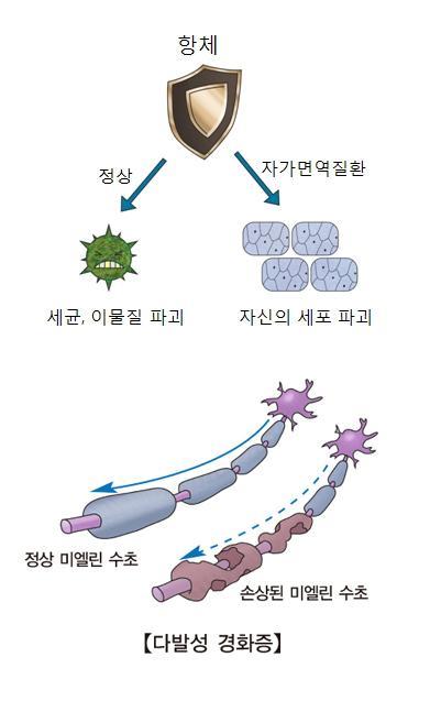 한국일보