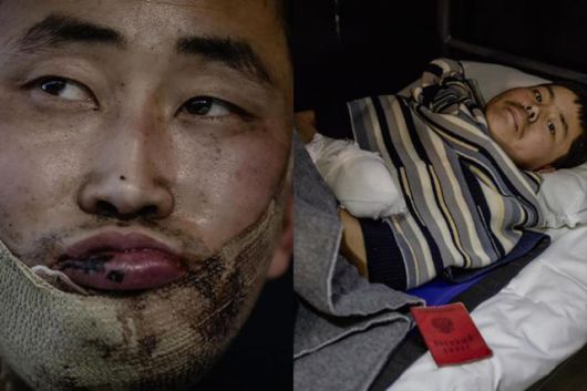 우크라이나군이 러시아 쿠르스크주에서 생포한 북한군 저격수(왼쪽)와 소총수의 모습. 현재 우크라이나 수도 키이우 모처에서 치료받고 있다. 볼로디미르 젤렌스키 우크라이나 대통령 엑스 캡처