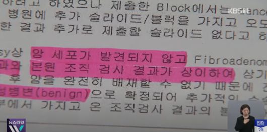16일 KBS 등에 따르면 지난해 유방암으로 진단받아 유방 절제 수술을 한 여성은 외부 병리기관의 실수로 다른 사람과 진단 결과가 바뀌었다. KBS News 캡처