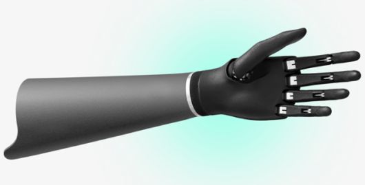 우크라이나 스타트업 에스퍼 바이오닉스가 개발한 생체공학 의수 ‘에스퍼 핸드’. 에스퍼 바이오닉스 홈페이지