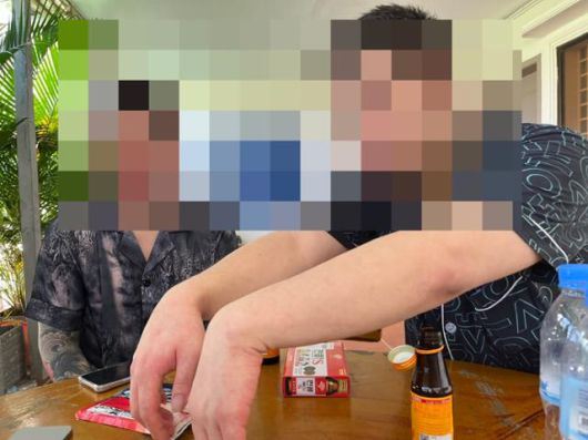 15일 캄보디아 시아누크빌주(州) 지방경찰청 이민국에서 만난 A(28)씨와 B(35)씨가 범죄단지 내에서 고문을 당한 경험을 말하며 흔적을 보여주고 있다. 시아누크빌=허경주 특파원