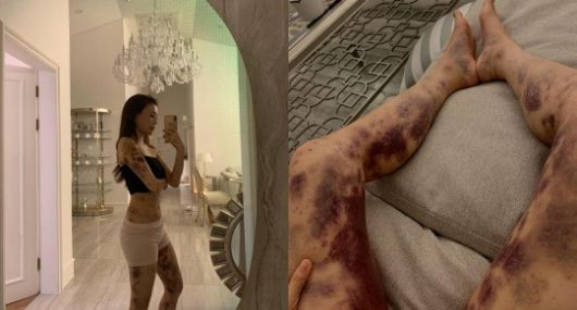 아옳이 인스타그램