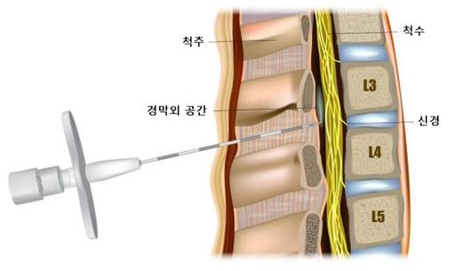 헤럴드경제