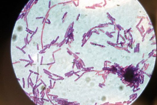 현미경으로 본 탄저균. [헤럴드DB]