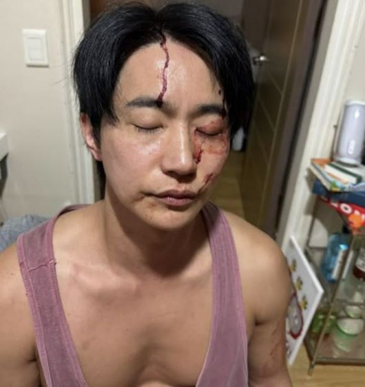 전호준 배우가 교제하는 연인과 몸싸움 사실을 공개한 사진. 전호준 SNS