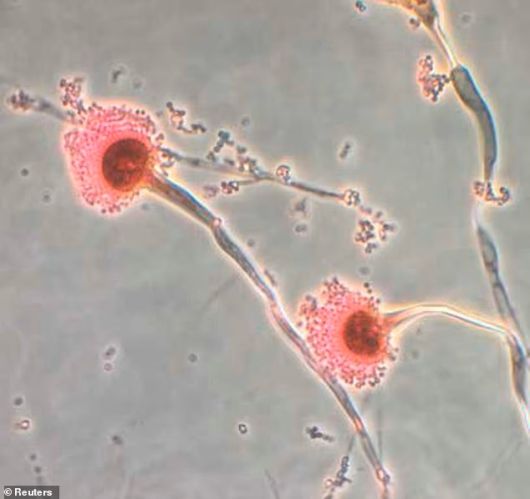 셰리 가오 미국 펜실베이니아대 화학·생물분자공학과 교수팀이 배양한 ‘아스페르길루스 플라부스(Aspergillus flavus)’ 곰팡이. [데일리메일]