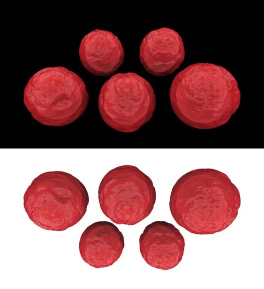 백일해를 일으키는 보르데텔라 페르투시스 박테리아. [게티이미지뱅크]