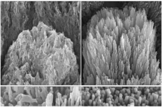 2주간 치료 후 재생된 법랑질 [노팅엄 대학교]