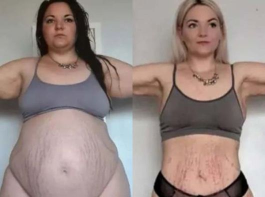 폭식증을 앓던 영국의 한 20대 여성이 2년 만에 45kg 감량에 성공했다. [더 선]