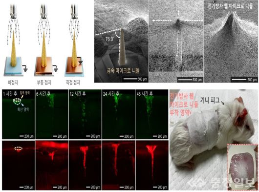 공동 연구팀 웨어러블 마이크로 니들 제작 및 약물전달 연구결과