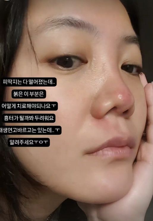 뉴스1