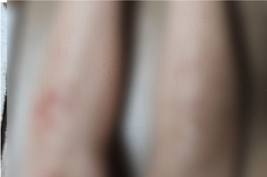 제품을 사용한 한 고객이 신체 일부 화상을 입었다고 주장했다. SNS 캡처