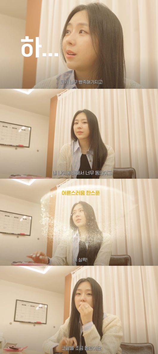 예원이 코 수술 이유를 밝혔다. 유튜브 채널 '예원' 캡처.