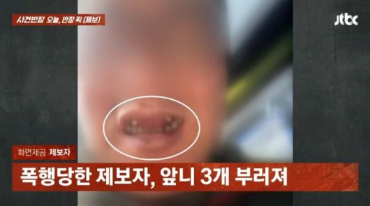 학창 시절 선배와 식사를 하던 중 돌연 폭행을 당한 남성의 사연이 공개됐다. JTBC '사건반장' 캡처